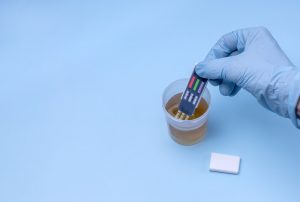 Lab technician’s hand dips substance test into urine sample.